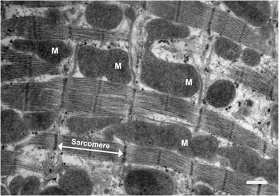Visualization of Dynamic Mitochondrial Calcium Fluxes in Isolated Cardiomyocytes